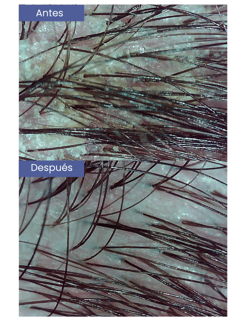 dermatitis_c-min