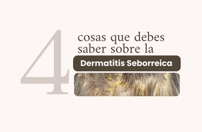 4 Cosas Que Debes Saber Sobre La Dermatitis Seborreica - Consultoría ...